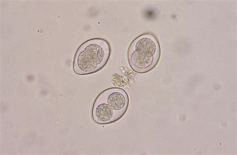 alcorfix|Cryptosporidium and Coccidia Exam, Fecal